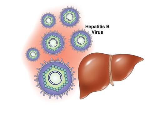 CGH：药物可阻止孕妇垂直传播乙肝病毒